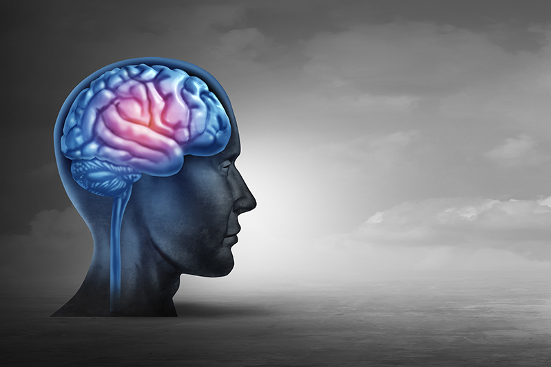 Illustration of brain with Alzheimer's